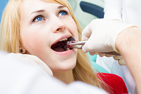 Teeth Extraction West Chicago