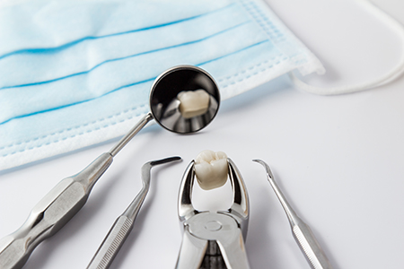 Teeth Extraction West Chicago